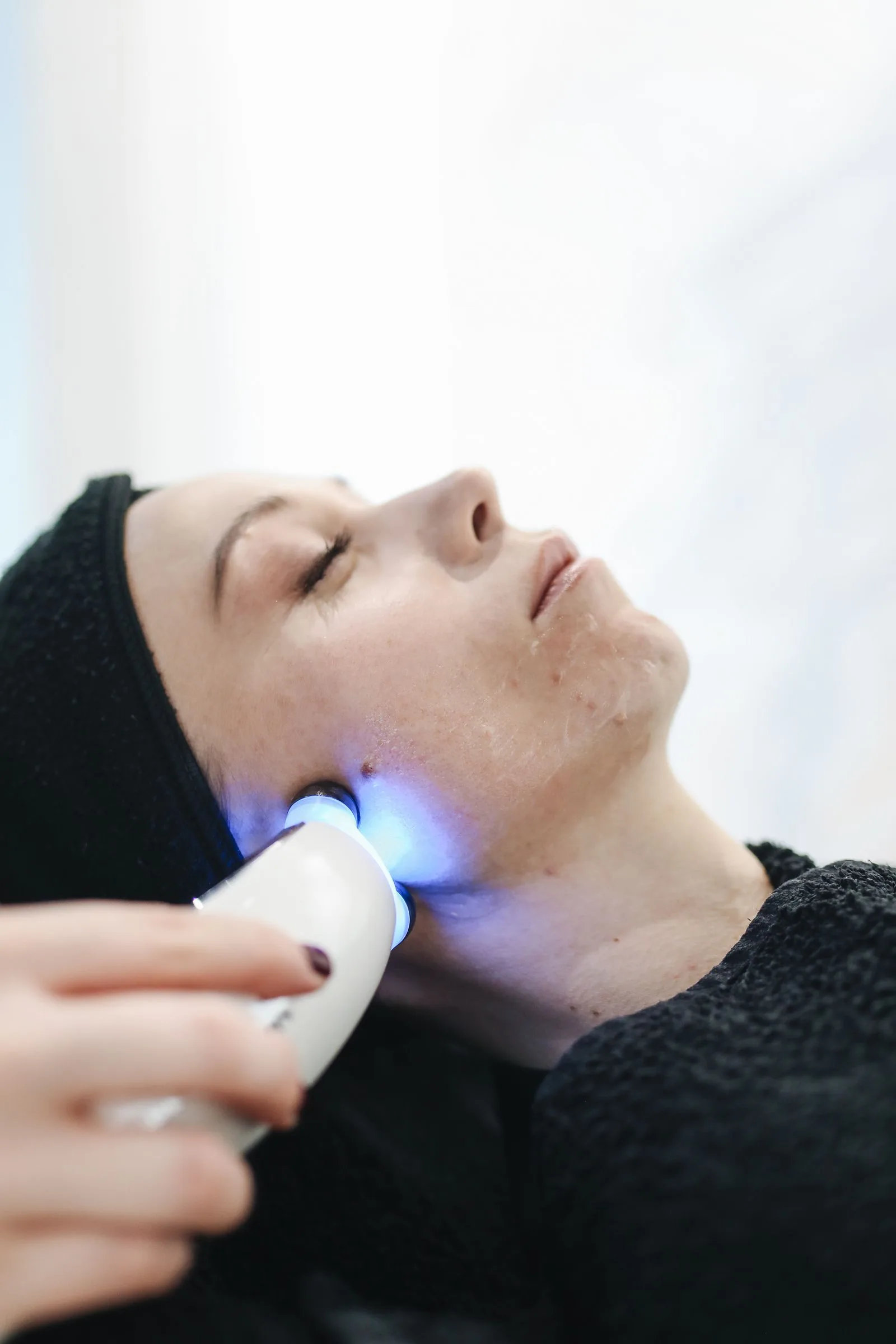 Yüz bölgesinde dermatolojik değerlendirmeye dair görsel